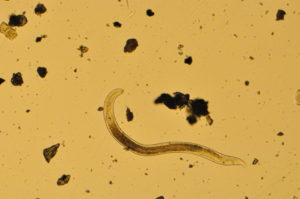 color photo of a nematode under microscope