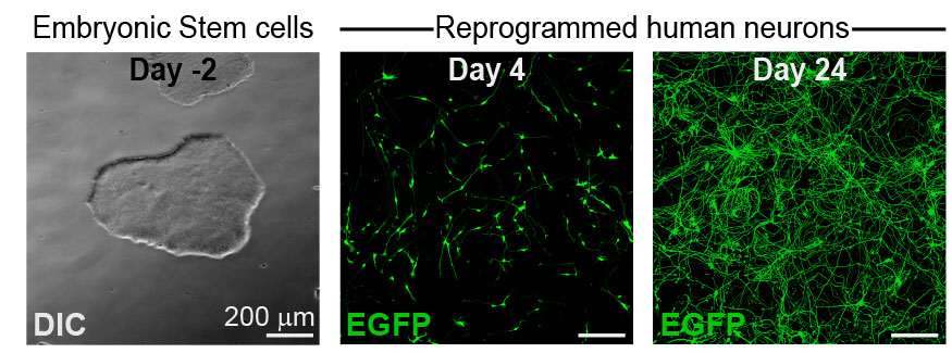 panel with stem cells, and two panels with developing neurons